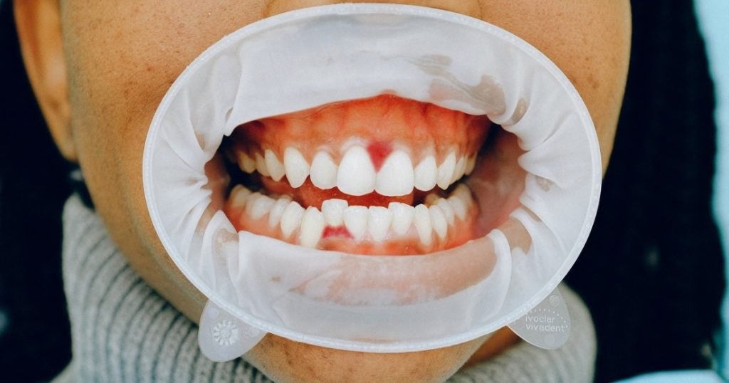 how long until a tooth infection kills you