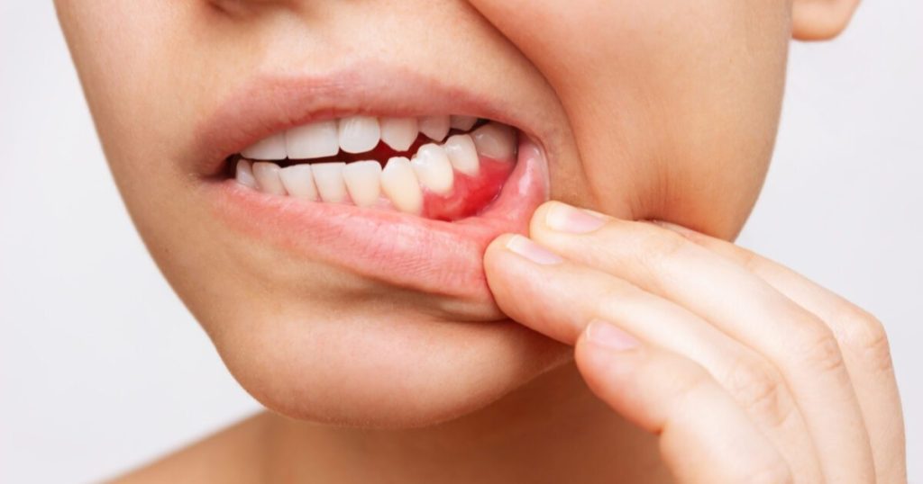 how long until a tooth infection kills you